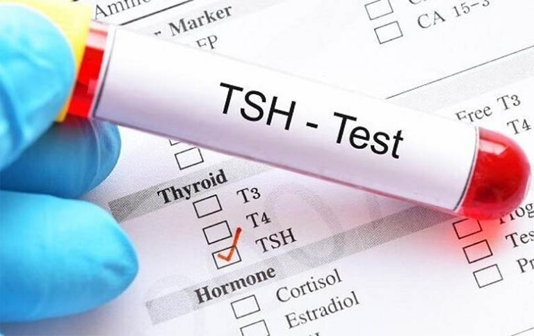 Ý nghĩa của các chỉ số trong xét nghiệm T3 T4 TSH 