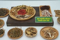 Bài Thuốc Mề Đay Thuốc Dân Tộc Giá Bao Nhiêu? Mua Ở Đâu?